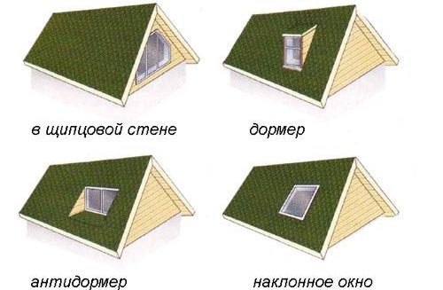 Классификация слуховых окон по форме